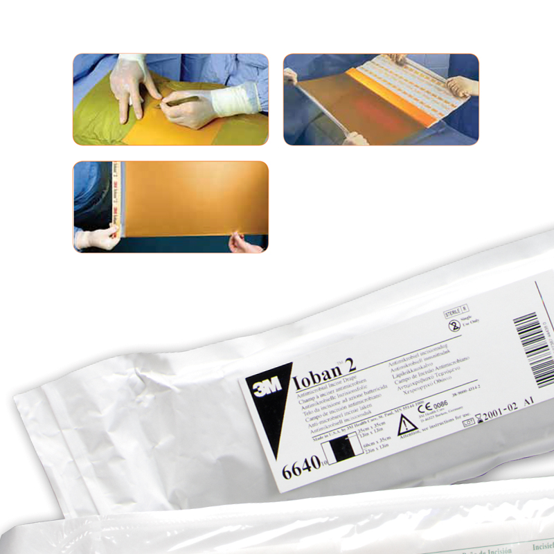 Incise Drapes Ioban